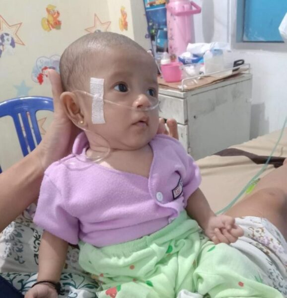 Butuh Uluran Tangan Dermawan, Bayi Mungil Haura AlMaira Berjuang Melawan Bocor Jantung
